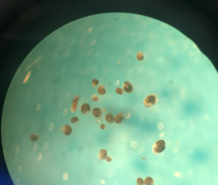 View through a microscope showing about 30 small brown oval shapes grouped together on a light green background
