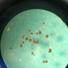 View through a microscope showing about 30 small brown oval shapes grouped together on a light green background