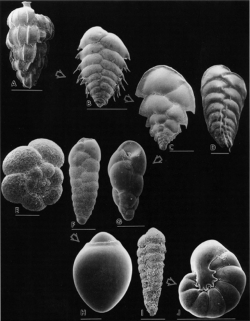 black and white scanning electron micrographs of forams